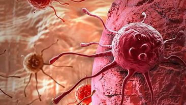 ABŞ-da xərçəngdən ölüm halları son 30 ildə 32 faiz azalıb