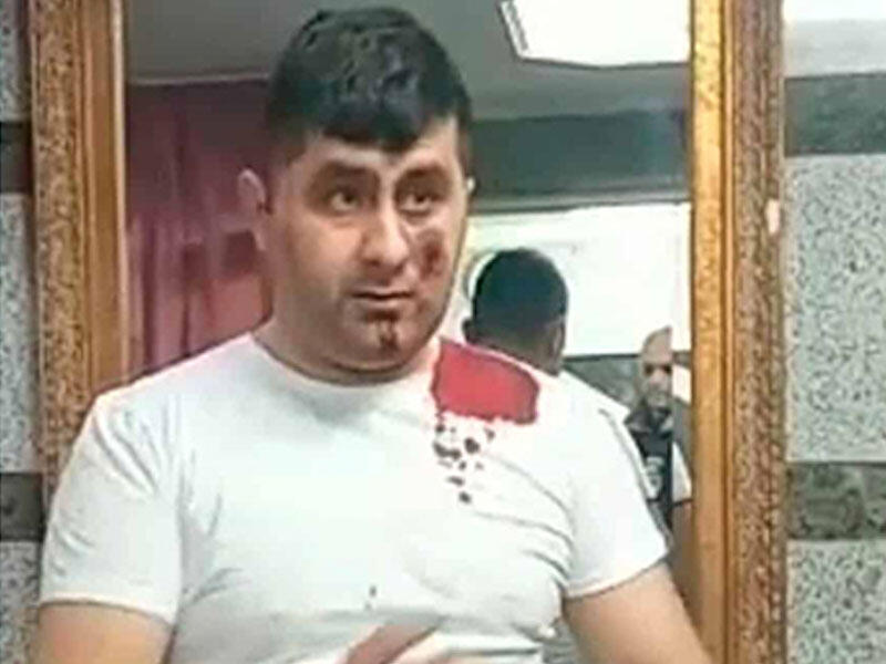 Ötən gün yaralanan Vasif 4 saatlıq əməliyyat keçirdi