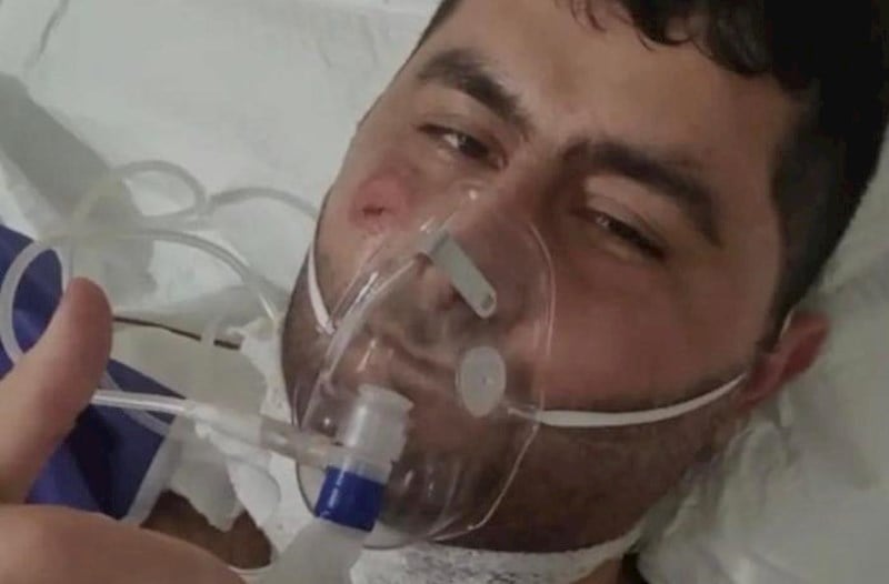 Əməliyyat zamanı Vasifin bədənindən 6 qəlpə çıxarılıbmış