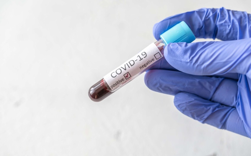 Azərbaycanda daha 28 nəfər koronavirusa yoluxub, 1 nəfər ölüb