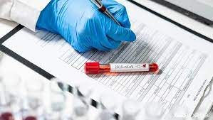 Azərbaycanda koronavirusa 28 yeni yoluxma qeydə alınıb, 3 nəfər ölüb