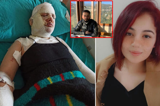 Zəlzələdə evinə sığınan keçmiş arvadının üstünə qaynar su tökən şəxs: “Yeraltı təkanlar səbəb oldu” - FOTO