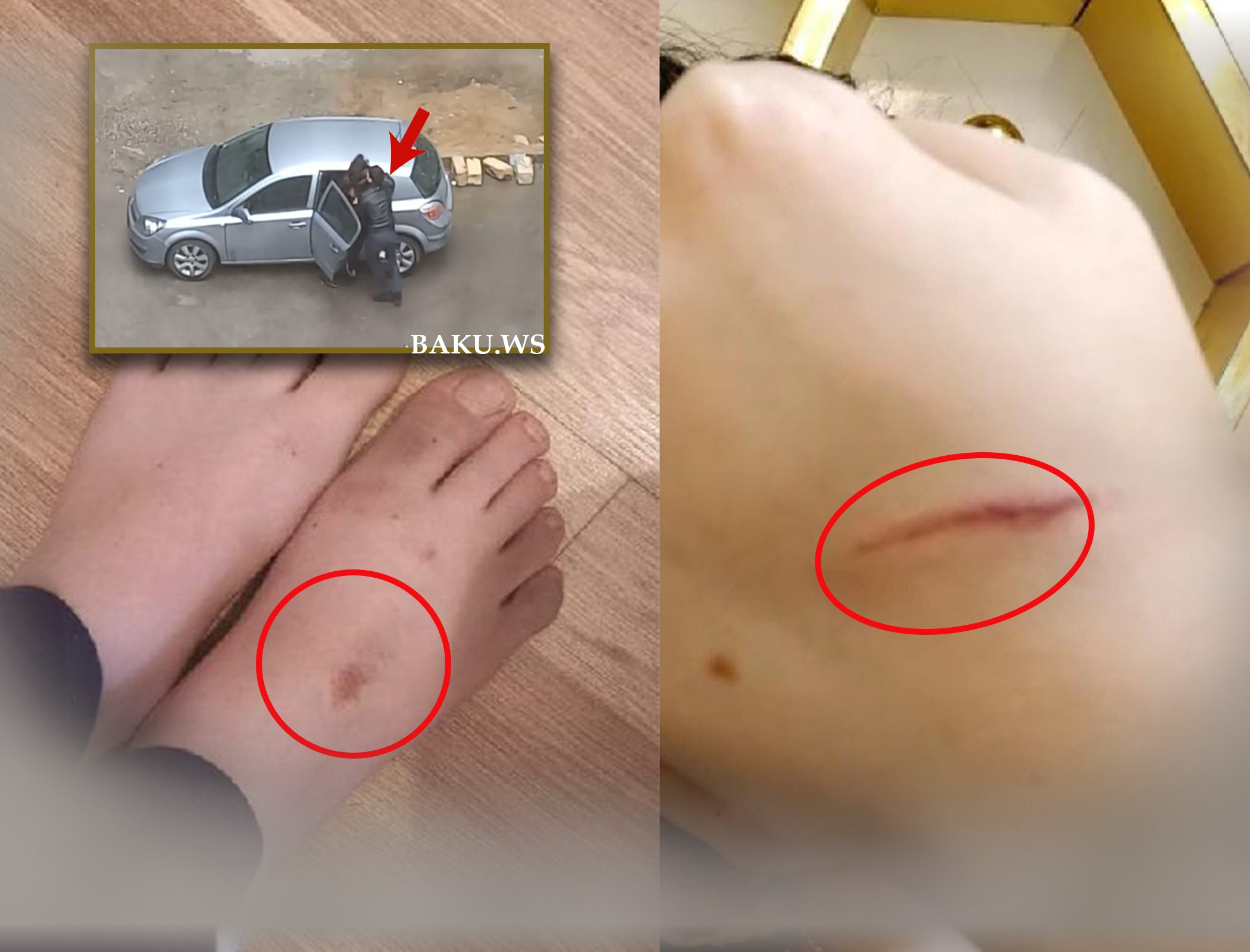 Küçədə qaçırılan qadınla bağlı ŞOK DETALLAR - Gələn gündən şiddət görür - FOTO