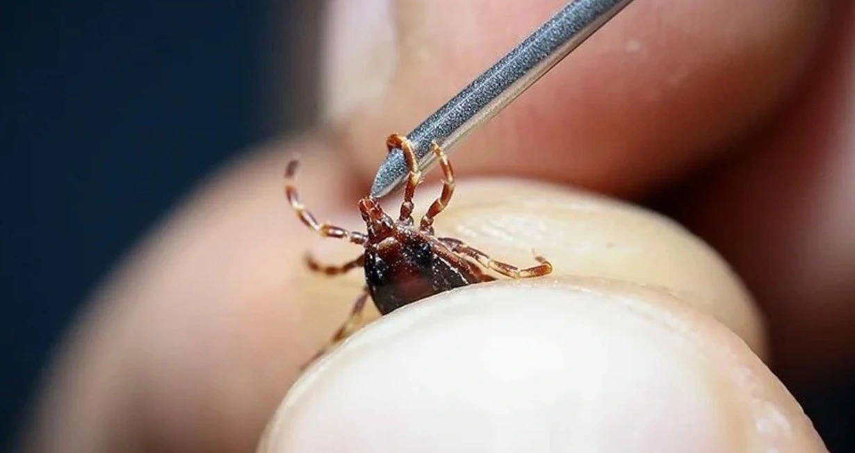 Gənə dişləməsindən müalicə alan şəxs öldü