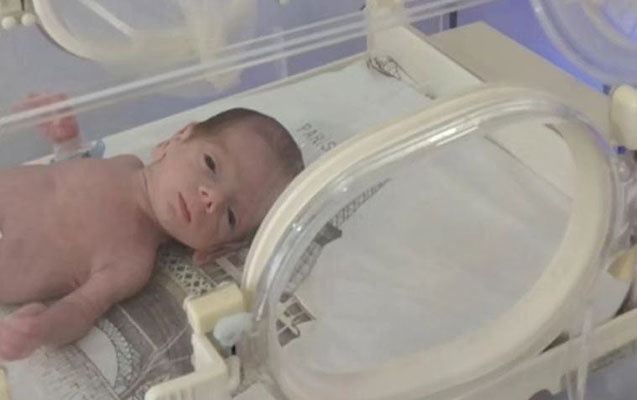Azərbaycanda 845 qramlıq körpə doğulub - Video