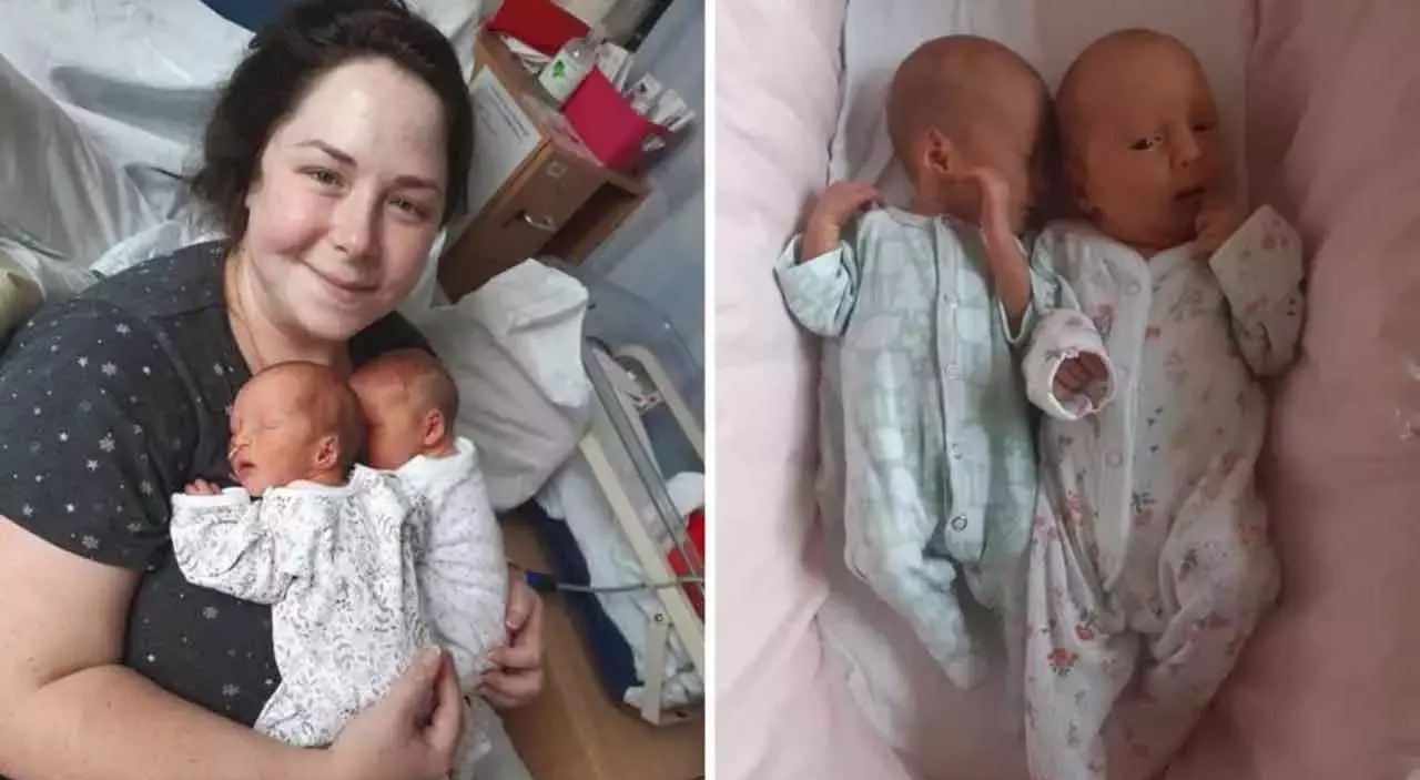 Eyni anda doğulan uşaqlar əkiz deyil - FOTO