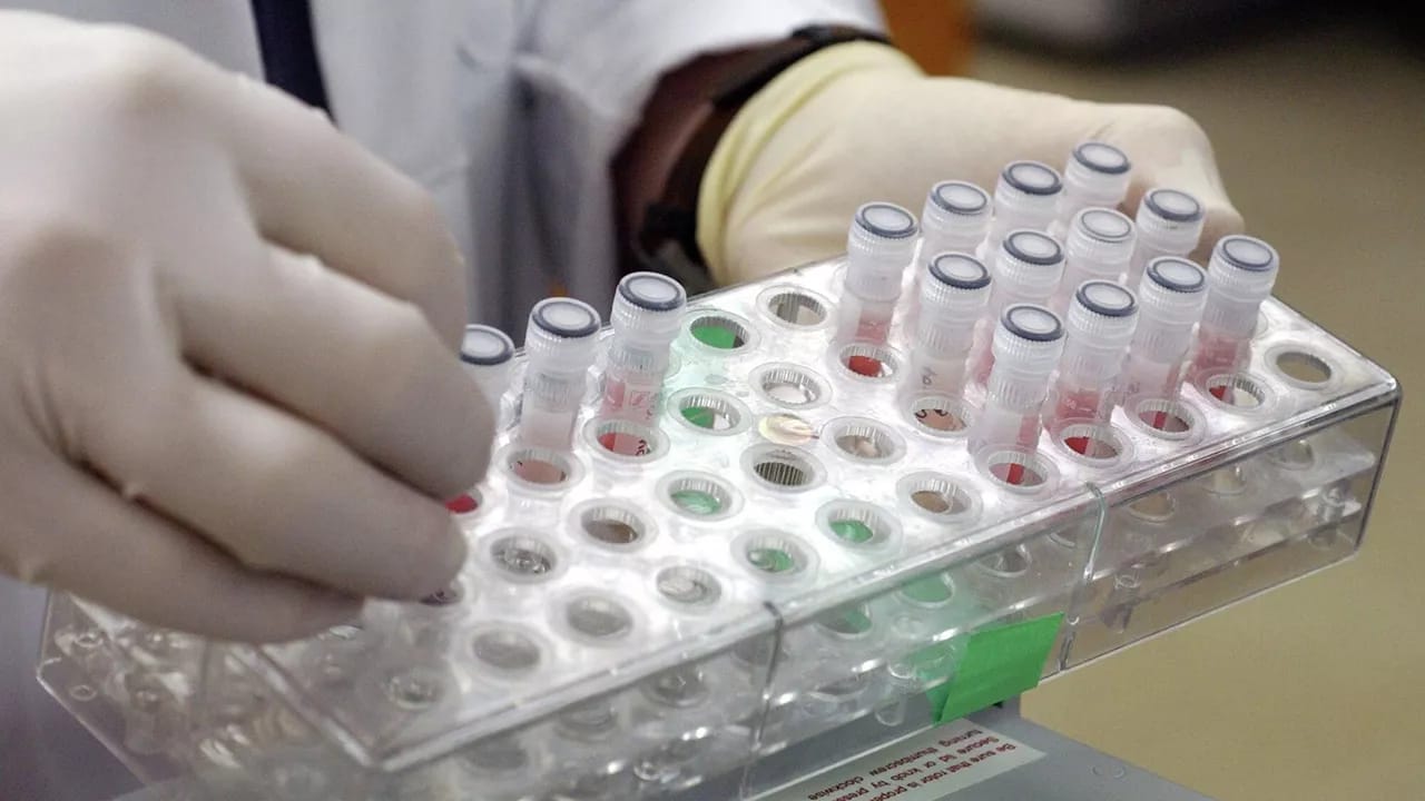 Alimlər süni intellektlə yeni antibiotiklər hazırlayıblar