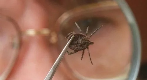 Gənə dişləməsi nəticəsində ölənlərin sayı artır - Mütəxəssislərdən xəbərdarlıq