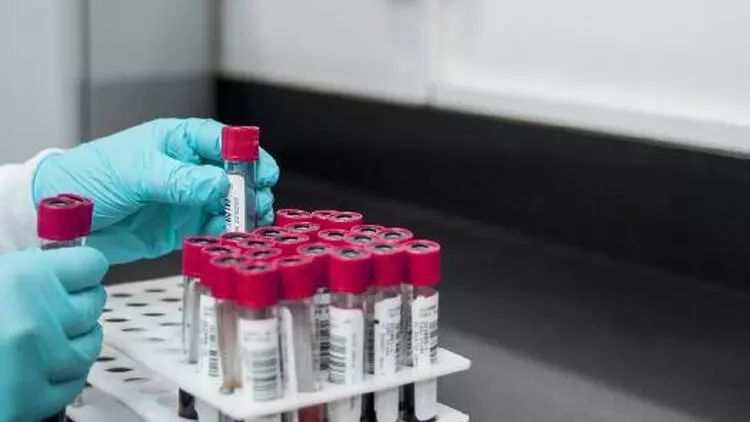 Böyük Britaniyada yoluxucu cinsi xəstəliklər rekord həddə çatıb