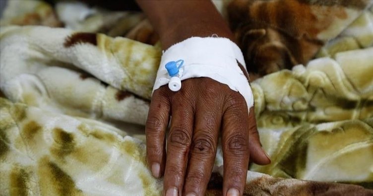 Cənubi Afrikada vəba epidemiyası nəticısində ölənlərin sayı 47-yə yüksəldi