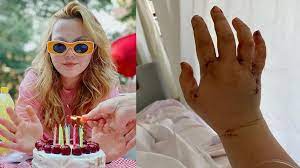 Əri tərəfindən 32 bıçaq zərbəsi alan fenomen sağ qaldı