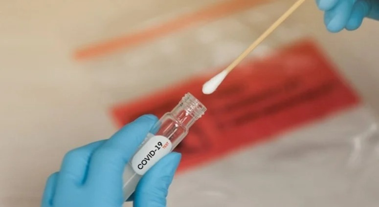 ÜST: Covid-19-a yoluxma sayı artmaqdadır