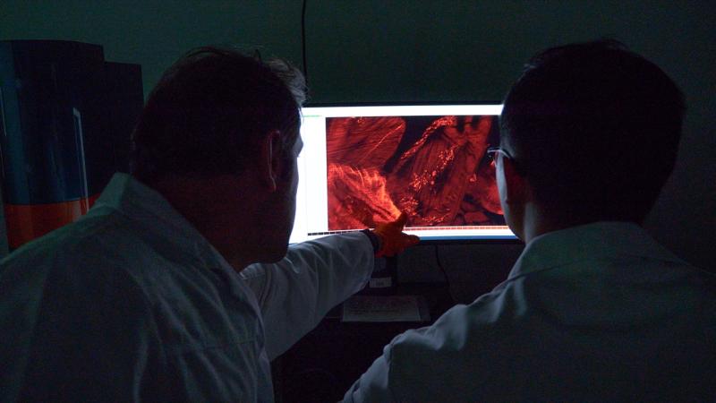 Dünyada 50 yaşdan aşağı xərçəngdən ölənlərin sayı durmadan artır - YENİ ARAŞDIRMA