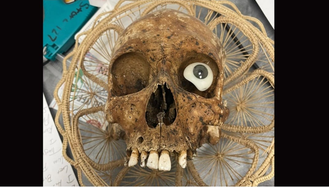 Dəhşətli hadisə: İanə qutusundan insan kəlləsi tapıldı