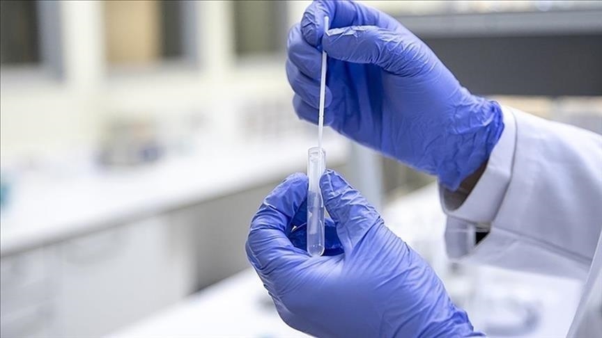 Türkiyədə “Eris” virusuna 9 nəfər yoluxdu