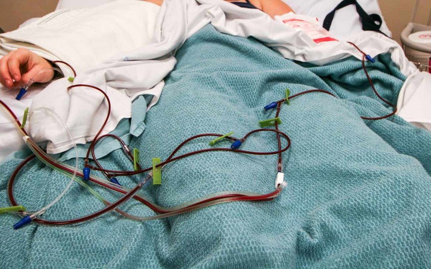 Sümük iliyi transplantasiyası cərrahi müdaxilə olmadan həyata keçiriləcək