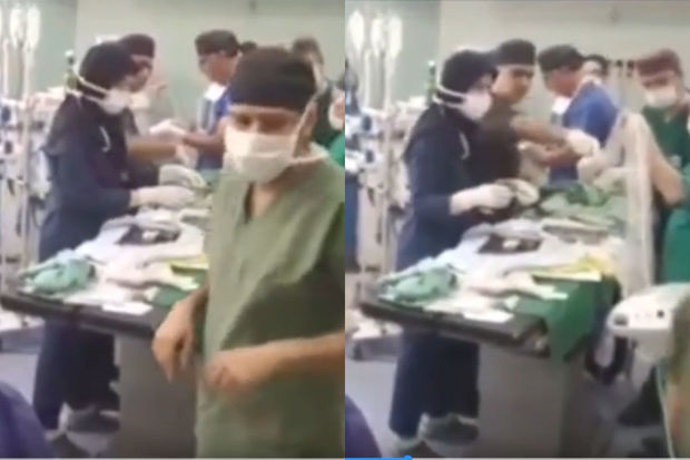 İranda siam əkizlərinin ayrılması əməliyyatı keçirilib - VİDEO