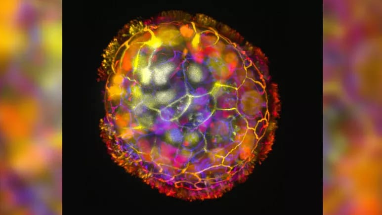 İnsan hüceyrələrindən robotlar yaradıldı