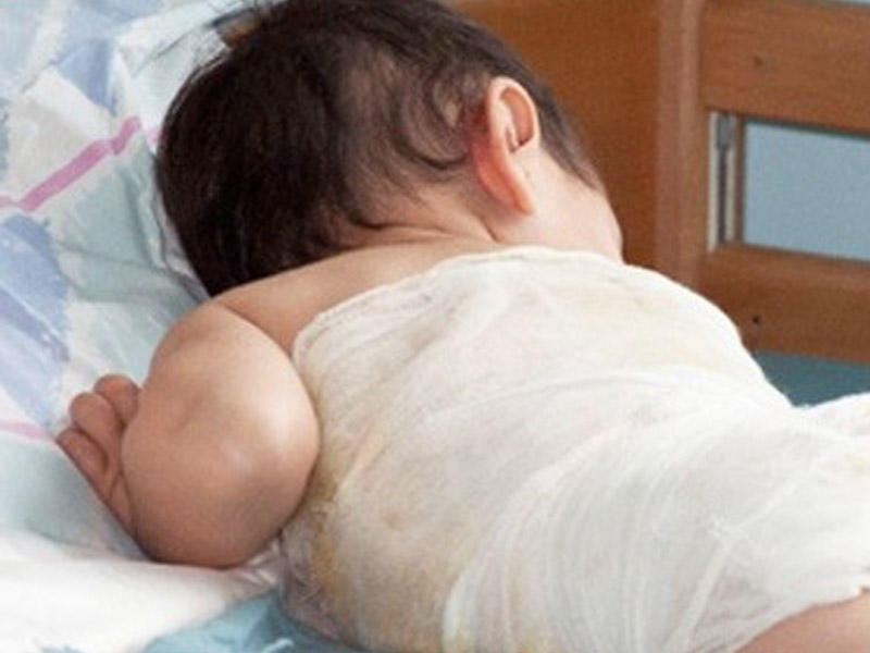 ŞOK OLAY: 7 aylıq uşağın belinə banka qoydular