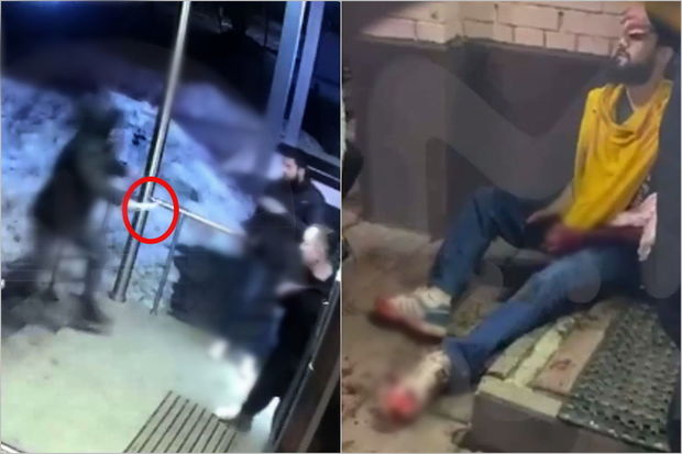 Moskvada bıçaqlı şəxs insanlara hücum edib: Yaralananlar var - ANBAAN VİDEO