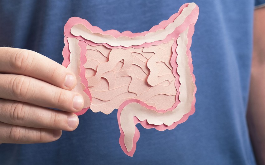 Alimlər: Diş əti xəstəliyi yüksək bağırsaq xərçəngi riski ilə əlaqəlidir