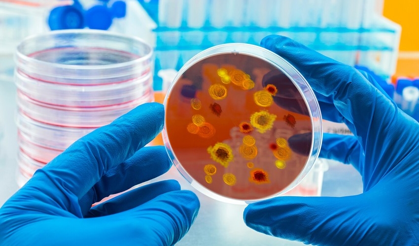 ÜST-dən SOS - Yeni epidemiya GƏLİR