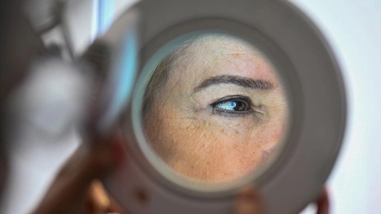 Bu amillər dəri xərçənginə yol aça bilər - Mütəxəssislərdən XƏBƏRDARLIQ