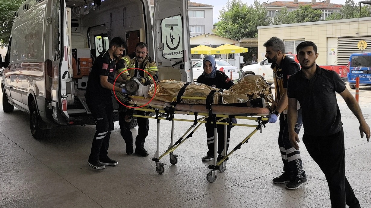 13 yaşlı uşağın qolu doğrama maşınına ilişdi