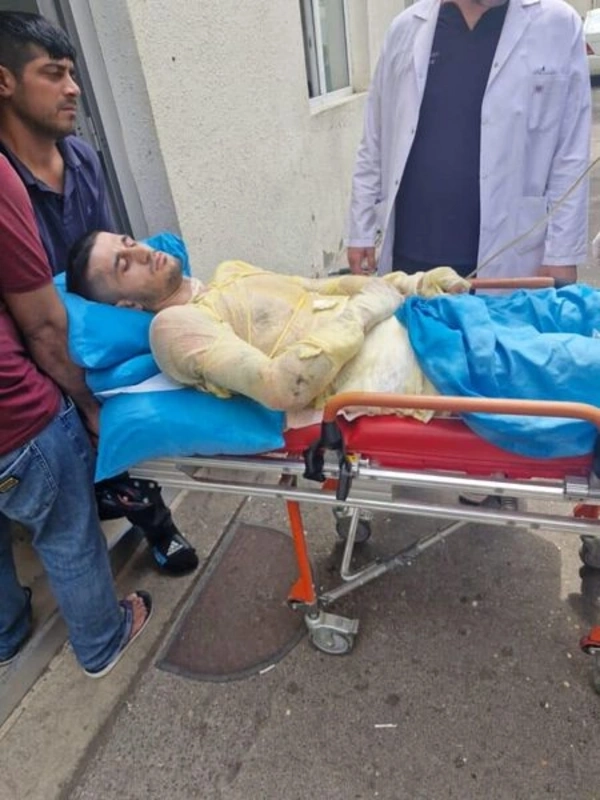 Qız qaçıran qazi özünü yandırıb - TƏFƏRRÜAT - FOTO