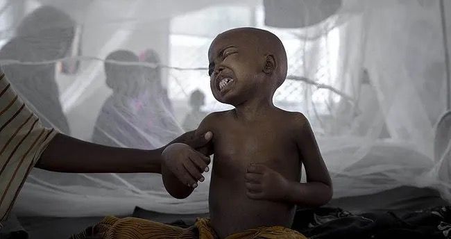 Nigeriyada vəba epidemiyası yayılıb: 156 ÖLÜ