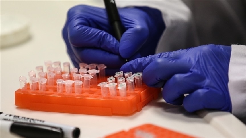 Pakistanda 3 nəfərdə M virusu aşkar edilib