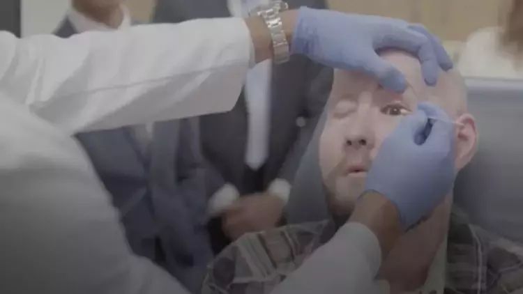 Dünyada ilk tam göz transplantasiyası reallaşıb