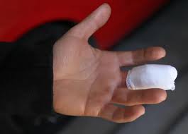 Rusiyada şok hadisə: Tanımadığı şəxs barmağını dişlədi, bir müddət sonra öldü