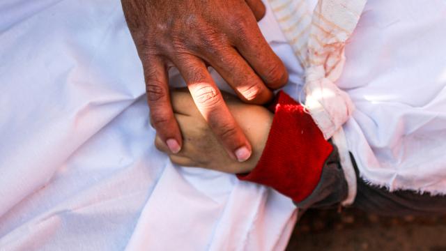 Qəzzada 710 uşaq öldürülüb