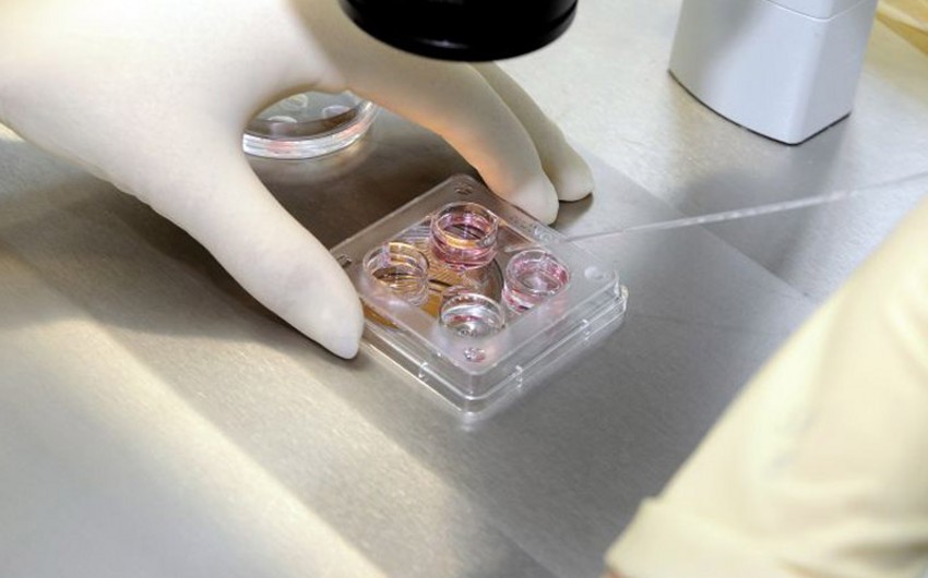 İtkin düşmüş şəxslərin ailələrindən 11 min 200-dən çox bioloji nümunə götürülüb