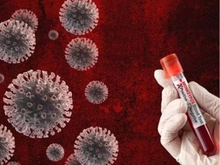 Konqoda 14 min insan Meymun çiçəyi virusuna qarşı peyvənd edilib