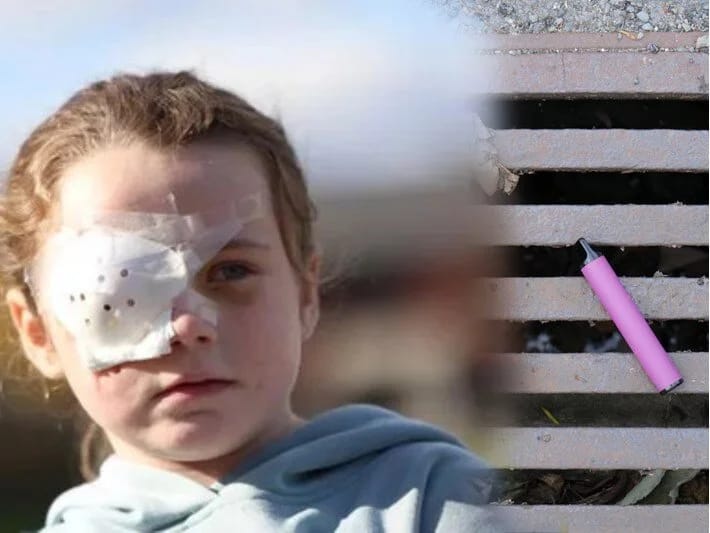 Elektron siqaret partladı, 7 yaşlı qız gözünü itirdi