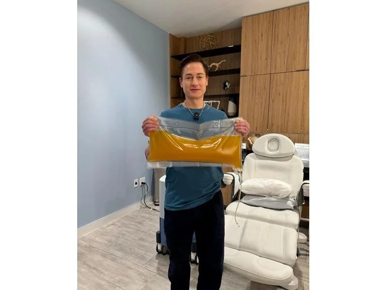 O, ölməmək üçün ildə 2 milyon dollar xərcləyir