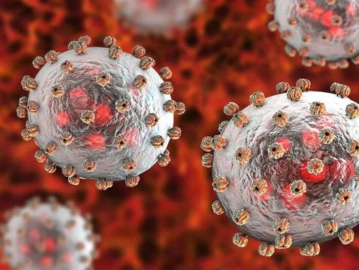 Nigeriyada Lassa qızdırmasından 21 nəfər ölüb