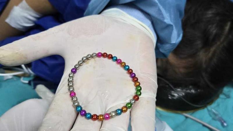 5 yaşlı uşağın bağırsağından 38 maqnit çıxarıldı