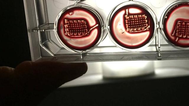 Xəstələrin qanı ilə qırılan sümükləri müalicə edəcək implant hazırlanıb