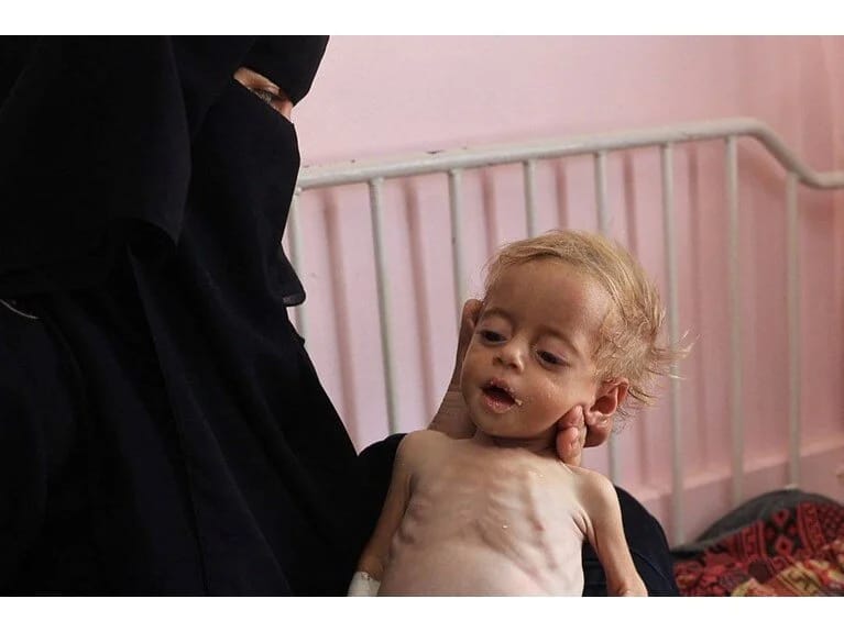 ABŞ İsraili qorumaq üçün gözlərini yumdu: Qəzzada aclıq yox idi!