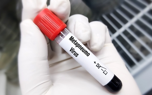 Daha bir ölkədə metapnevmovirus yoluxması aşkar edilib