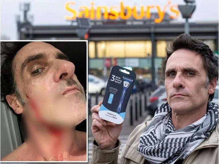 Üzünü ülgüclə kəsdi, 6 min 650 dollar qazandı