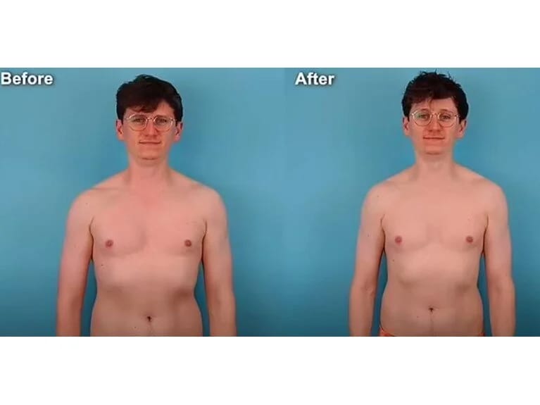 Həftədə 250 min addım atdı: Bədənindəki dəyişiklik təəccüb doğurdu