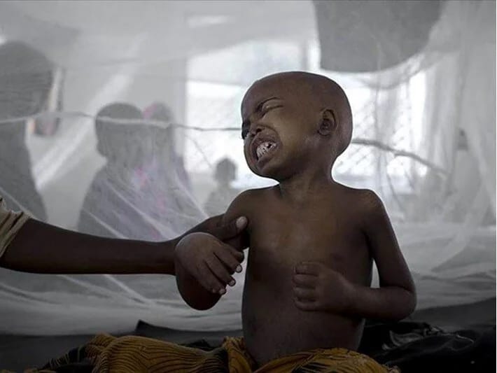 Sudanda vəba epidemiyası: Ölənlərin sayı 334-ə yüksəldi