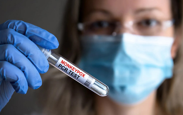 Azərbaycana da gəlib çatdı - Necə qorunaq?