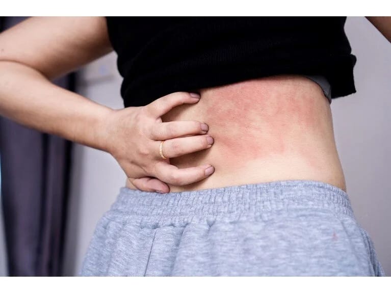 19 yaşlı gənc qızın həyatı kabusa çevrildi: Su içə bilər, amma toxuna bilməz