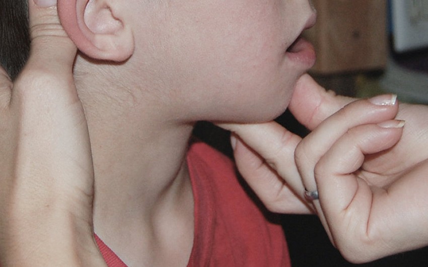 Uşaq cərrahı çöpçülərlə bağlı valideynlərə müraciət edib