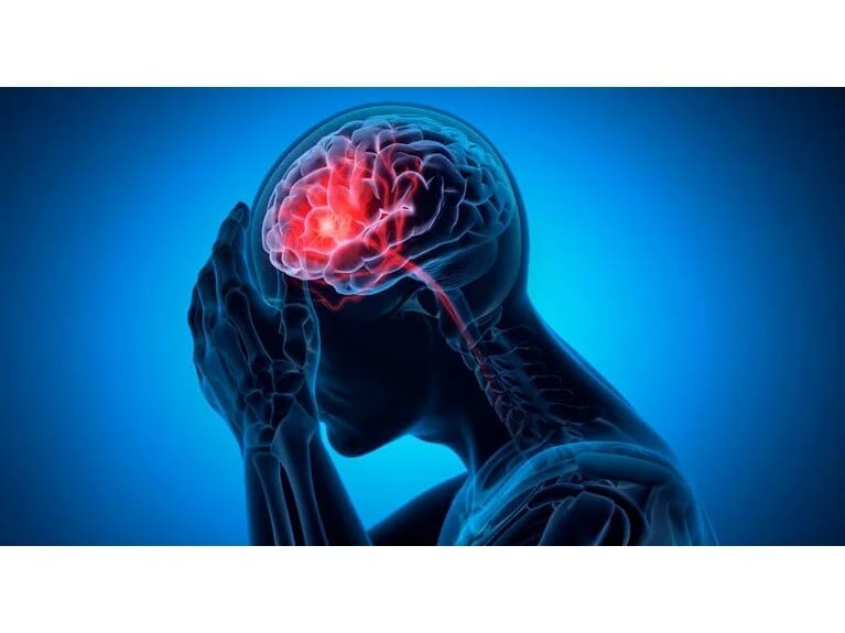 Alimlər açıqladı: Gənclərdə insult riski 7 dəfə artıb